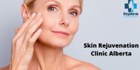 Radio Frequency for Skin Treatment in Edmonton | Oxyderm laser clinic